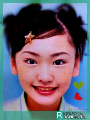 新垣結衣の高校や中学の学歴 卒アルまとめ 歯茎を治した真相